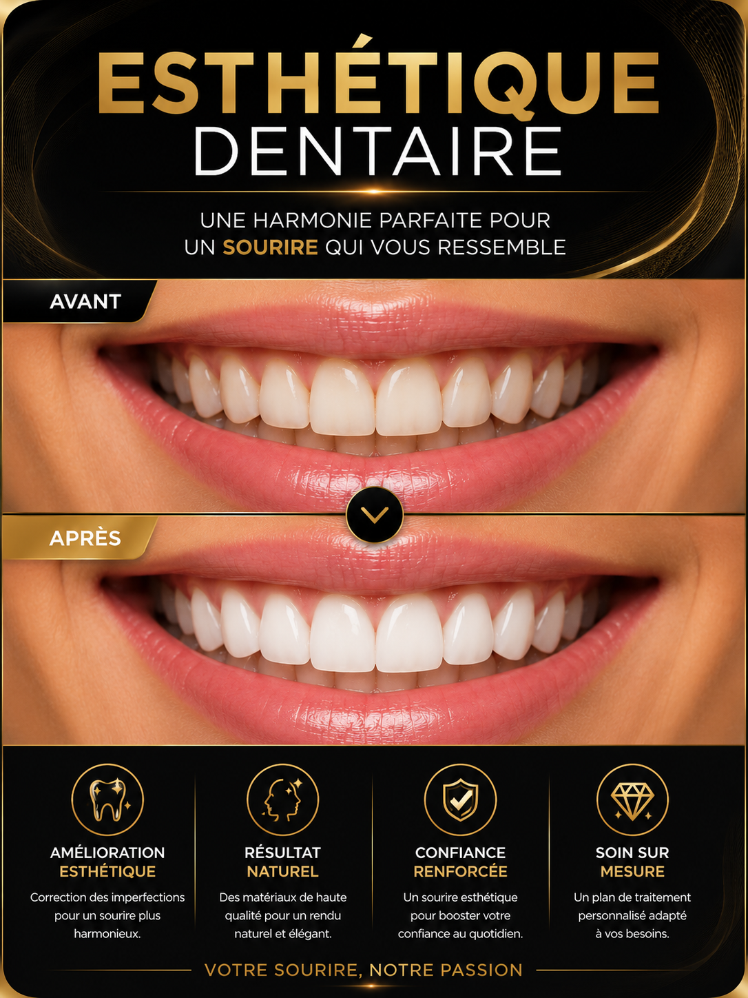 Transformation dentaire