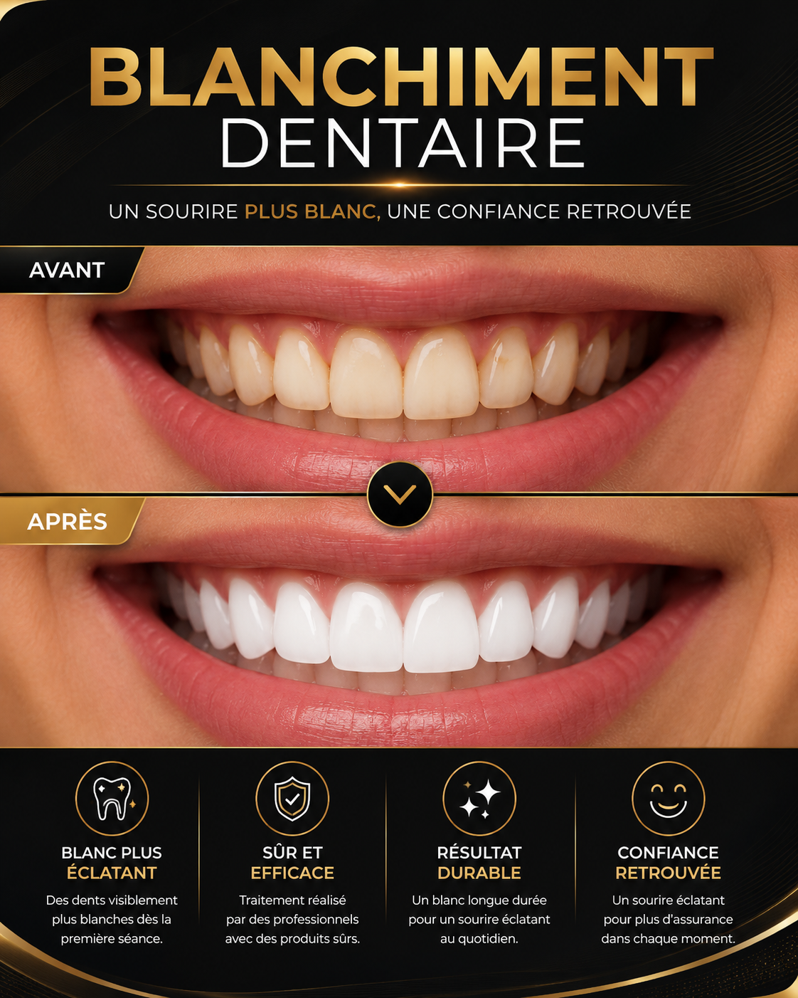 Blanchiment dentaire