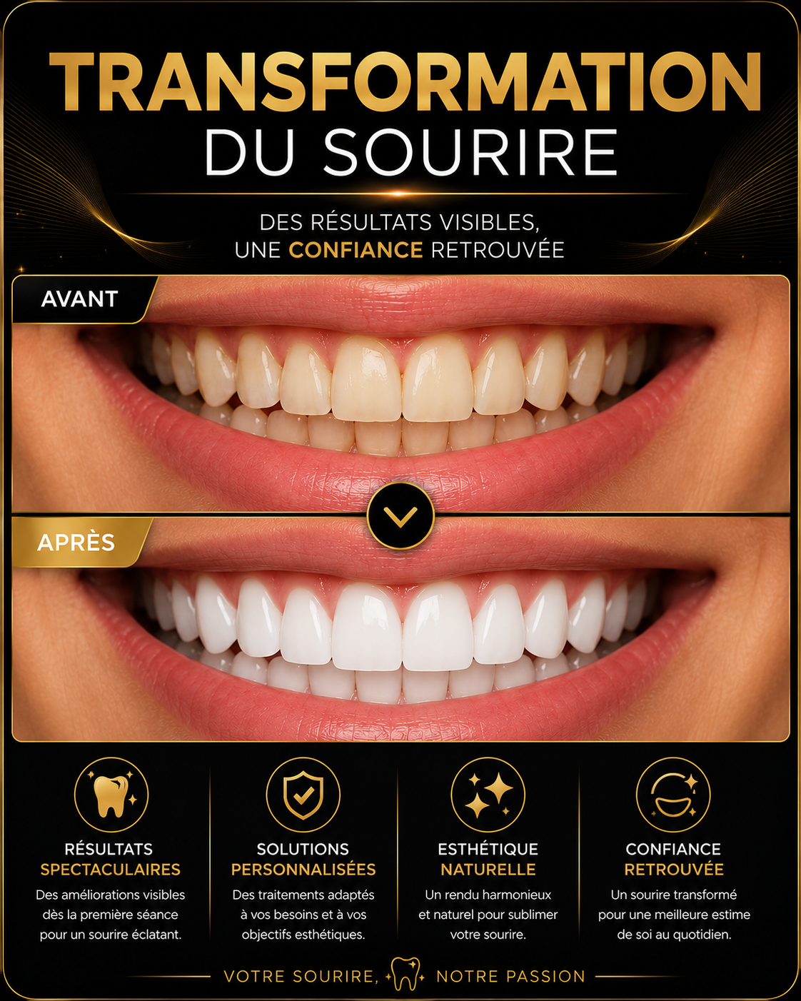 Résultat dentaire